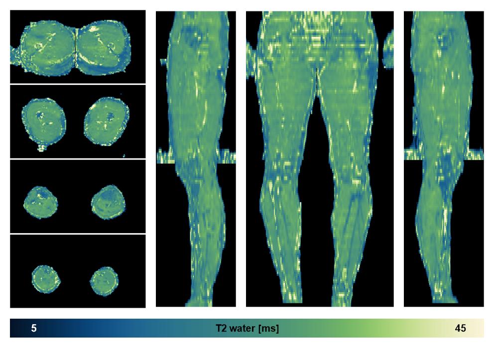 The water only T2 relaxation time of the lower extremity obtained from multi echo spin echo t2 mapping with EPG based reconstruction.